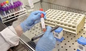 UnB realiza pesquisa sobre uso de plasma de pessoas infectadas pela Covid- 19