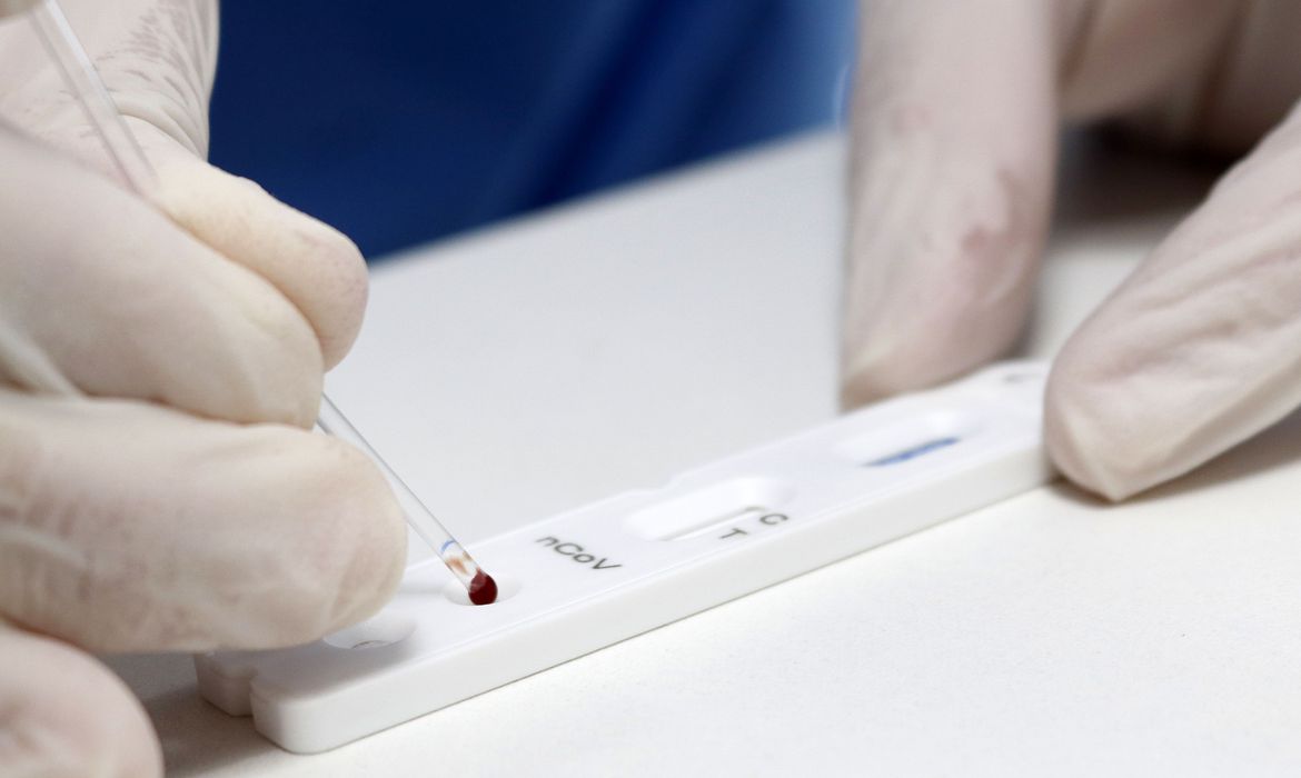 Brasil registra 106.523 mortes e 3,27 milhões de casos de Covid-19