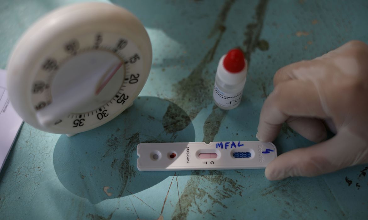 Butantan oferece testagem gratuita de covid-19 na capital paulista